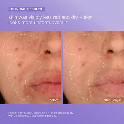 Stabilizing Repair Serum 50ml