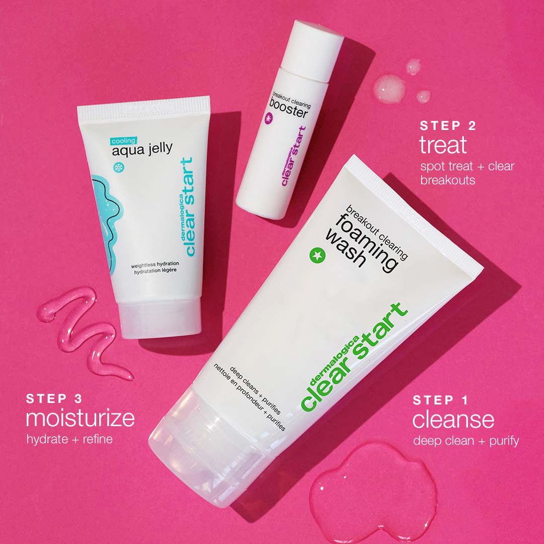 Clear Start Breakout Clearing Kit